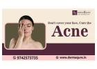 Get Your Clear skin Through Acne Treatment in Bangalore - Dermaqure Skin and Cosmetology Clinic