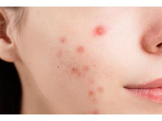 Best Dermatologist in South Delhi