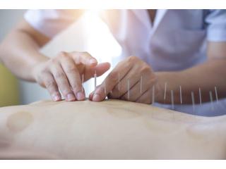 Acupuncturist in Adelaide at Yihong Acupuncture Clinic