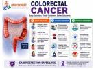 Colorectal Cancer Specialist in Mumbai | Dr. Sanket Shah