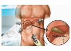 Affordable Gallbladder Stone Surgery Packages in Kolkata