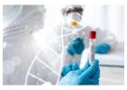 Flexible Mobile Blood Testing Services in The USA