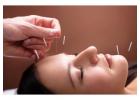 Experience Vibrant Wellness: Acupuncture Therapy Clinic New York City