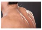 Ease Stiffness With Acupuncture for Tight Back Muscles