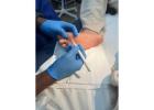 Professional Skin Treatment in Buckingham – YourSkin MK