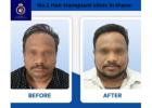 No. 1 Hair Transplant & Hair Restoration Clinic in Thane | DNA Royal.