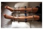 Limb Lengthening Surgeon in Delhi for Specialized Care