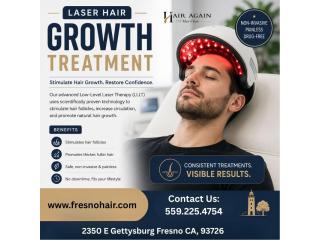 laser hair growth treatment Fresno