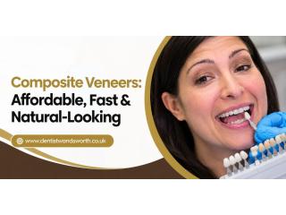 Composite Veneers: Affordable, Fast & Natural-Looking