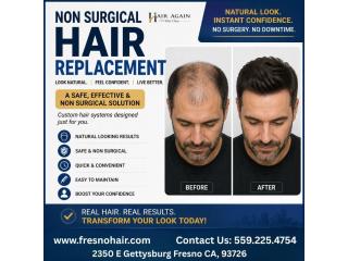 Non Surgical Hair Replacement For Men in Fresno