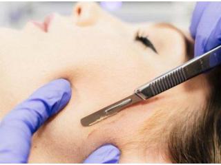 Dermaplaning Facial Tampa for Smooth and Radiant Skin