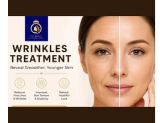 Advanced Treatment for Deep Facial Wrinkles in Thane | DNA Royal.