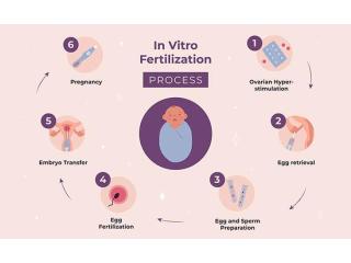 IVF Treatment in Delhi - Dr Rhythm Gupta