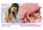 Effective Eczema Treatment for Healthy Skin - Dr. Priya Skin and Hair Clinic