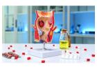 Hemorrhoids Treatment for Lasting Comfort and Better Care by Dr. Kyriakos Neofytou