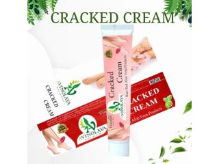 Best Cream for Cracked Heels for Soft and Smooth Feet