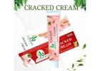 Best Cream for Cracked Heels for Soft and Smooth Feet