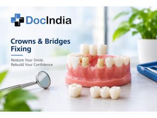 Best Crowns and Bridges Fixing Doctors in Delhi - DocIndia