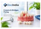 Best Crowns and Bridges Fixing Doctors in Delhi - DocIndia