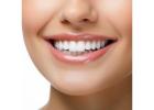Trusted Cosmetic Dentistry in New York from Experienced Brooklyn Dental Experts