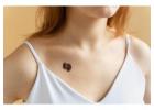 Skin Tag Removal in Delhi