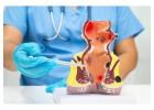 Expert Fissure Surgeon in Kolkata – Dr. Purnendu Roy
