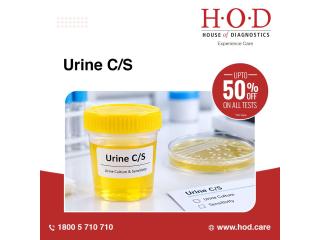 Understanding the Role of Urine Culture in UTI Evaluation