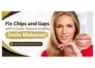 Fix Chips and Gaps with a Quick, Natural-Looking Smile Makeover