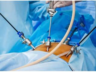 Laparoscopy for Infertility in Delhi - Dr Rhythm Gupta