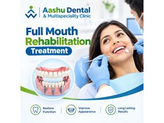 Complete Dental Restoration | Full Mouth Rehabilitation Treatment