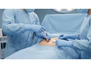 Best Laparoscopic Surgeon in Kolkata for Advanced Surgery