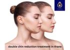 Double Chin Reduction Treatment in Thane | DNA Royal.