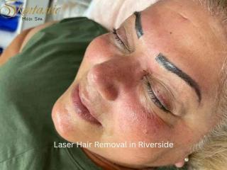 Affordable Laser Hair Removal Services in Riverside