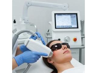 Laser Tattoo Removal for Clear, Smooth Skin