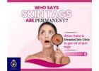 Affordable Skin Care Clinic in Thane – DNA Royal.