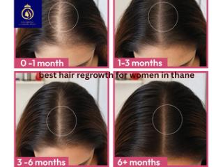 Best Hair Growth Treatment for Women in Thane | DNA Royal.