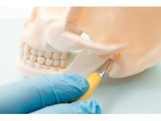 Gum Disease Treatment Melbourne for Healthy Gums and Strong Teeth