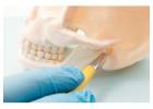 Gum Disease Treatment Melbourne for Healthy Gums and Strong Teeth