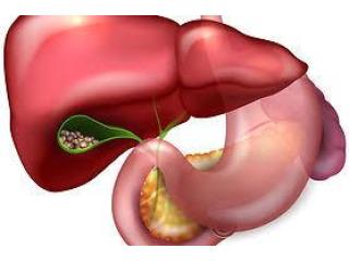 Skilled Surgeon for Gall Stone Treatment in Kolkata