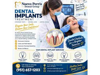 Dental Implants Treatment in Menifee, CA – Restore Your Smile