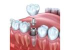 Your Trusted Dentist for Dental Implants & Complete Family Dentistry