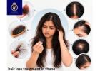 Effective Hair Loss Treatment in Thane at DNA Royal.