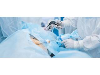 General and Laparoscopic Surgery in Panchkula
