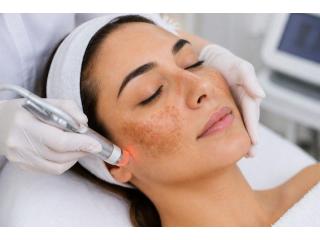 Best Melasma Treatment in Delhi for Clearer-Looking Skin