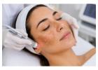 Best Melasma Treatment in Delhi for Clearer-Looking Skin