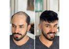 Premium Natural Hair Patch Service in Nagpur