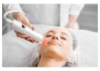 What Should You Consider When Choosing a Laser Facial in Boston?