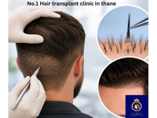 DNA Royal – Leading No.1 Hair Transplant Clinic in Thane for Advanced Treatments.