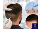 DNA Royal – Leading No.1 Hair Transplant Clinic in Thane for Advanced Treatments.