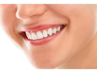 Burton Family Dental | Trusted Dental Care in Burton MI
